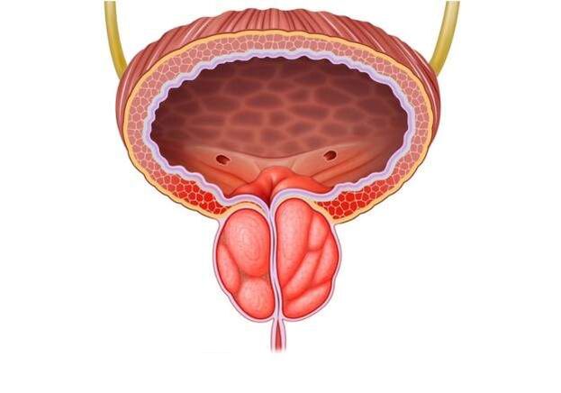 tratamento da prostatite nos homes